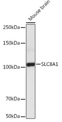 Western Blot: Sodium Calcium Exchanger 1/NCX1 AntibodyAzide and BSA Free [NBP2-94316]